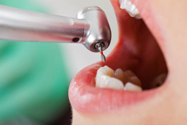 Best Urgent Care for Lost Fillings or Crowns in Ewa Gentry, HI